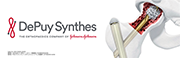 DePuy Synthes